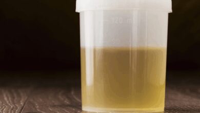 cloudy urine